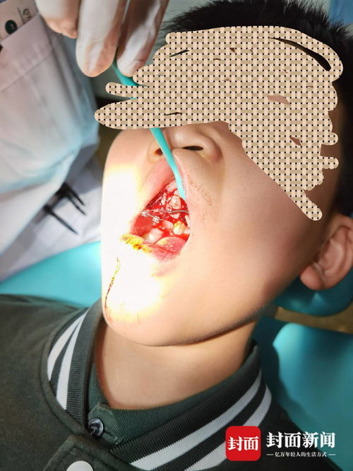 重慶特斯拉車主遭遇驚魂一幕 停車時(shí)車輛自動(dòng)加速撞墻，致孩子受傷